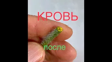 Изменение КРОВИ после ЧИСТОТЕЛА