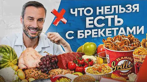 НЕ ЕШЬ ЭТО с брекетами! 10 запрещенных продуктов